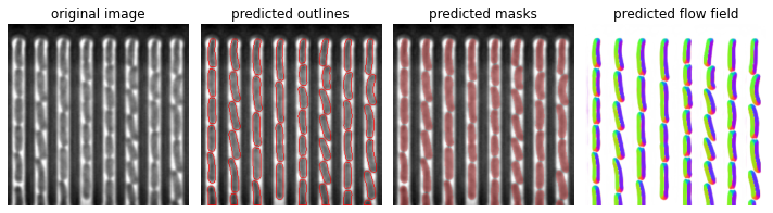 ../_images/examples_seg_with_omnipose_11_0.png